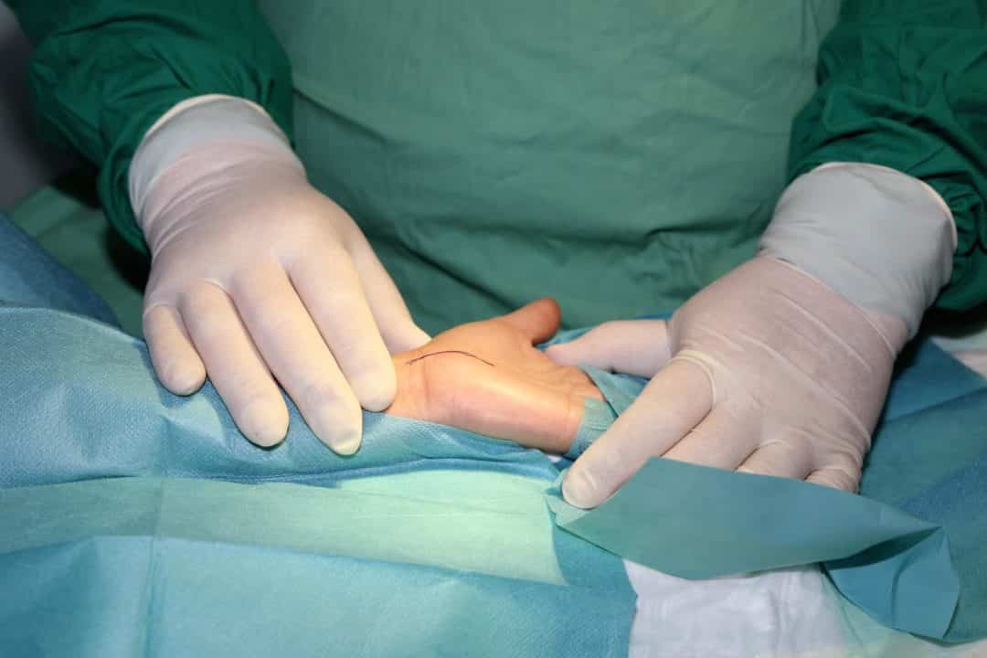 pr-eric-roulot-chirurgie-main-chirurgie-poignet-paris-poignet-os-main