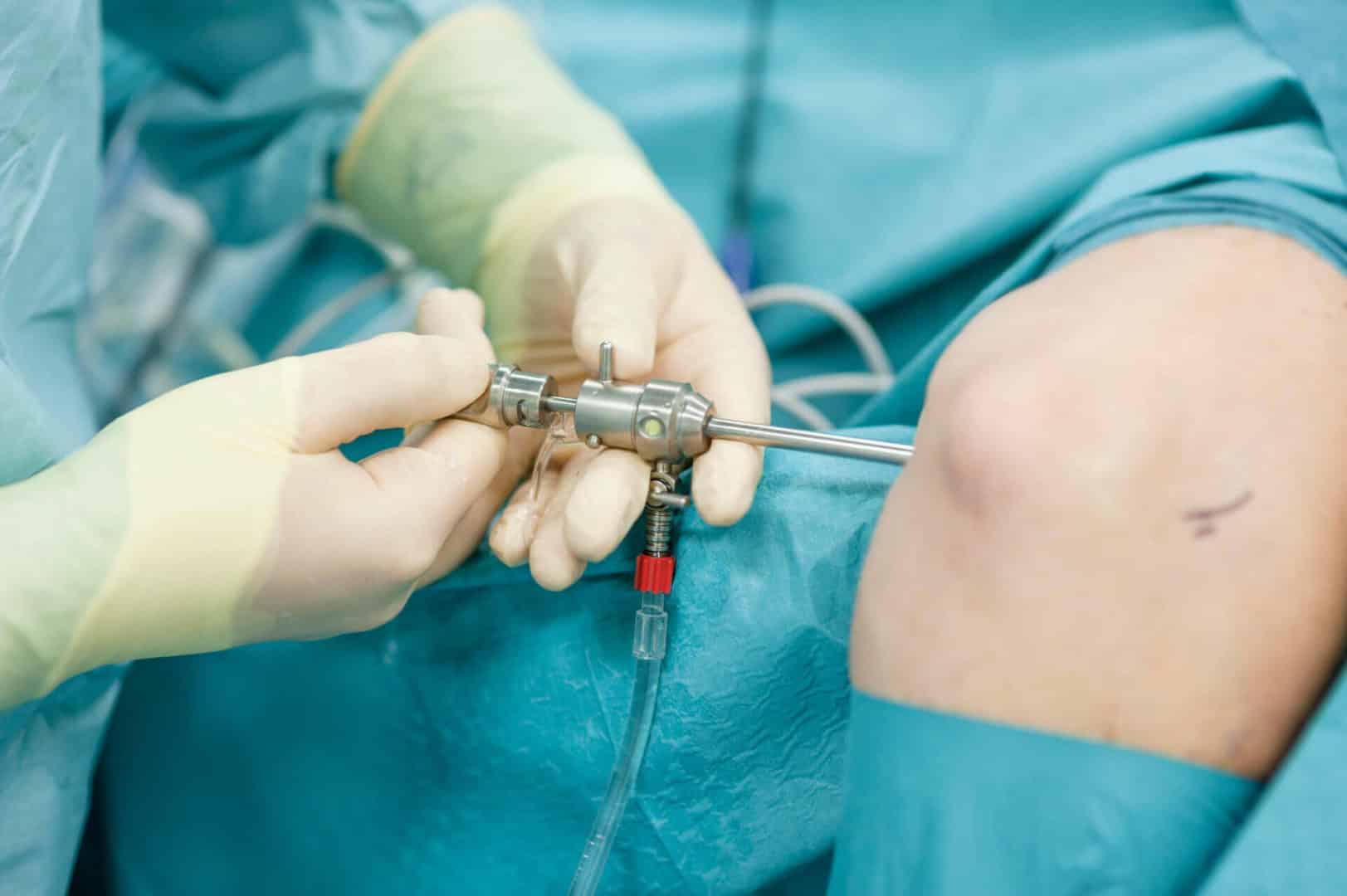 Chirurgie de la main à l'épaule - Chirurgie du membre supérieur | Pr Roulot