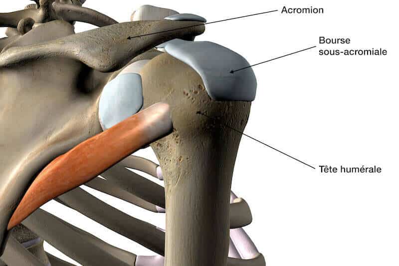 douleur bursite de l épaule- acromion agressif épaule - acromion crochu épaule - acromion courbe épaule