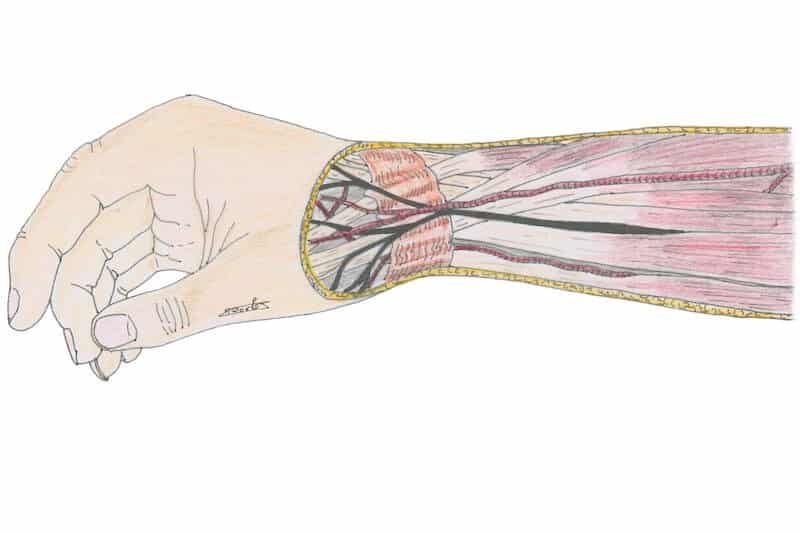 tendinite de quervain opération - operation tendon flechisseur pouce - anatomie tendon long extenseur pouce