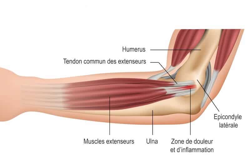 anatomie coude epycondile laterale