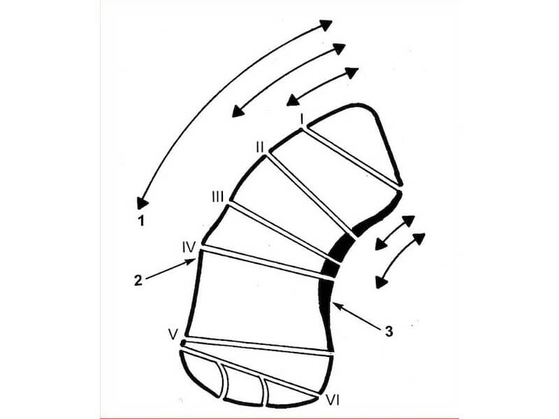 dessin fractures possibles
