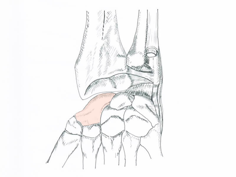 Anatomie carpe os poignet