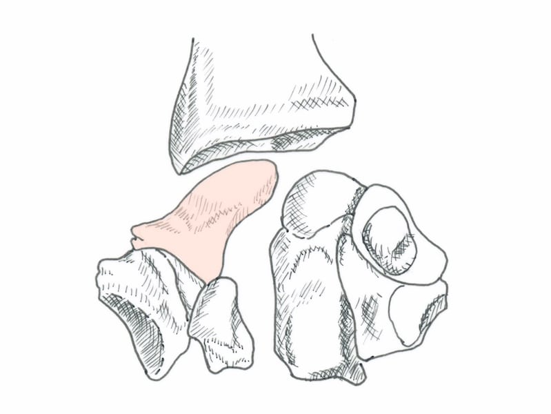 os scaphoïde colonne externe carpe