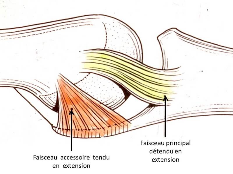 entorse ligament collatéral ulnaire pouce